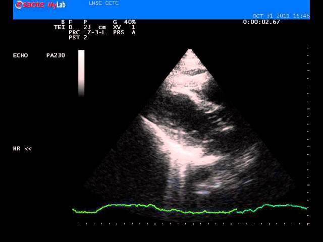 Case of the Month # 1 - Cardiac