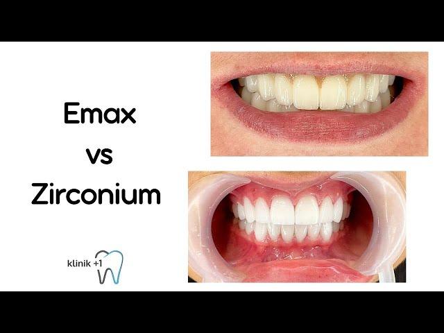 Emax vs. Zirconium Dental Crowns: A Comparative Analysis-Klinik+1 İstanbul Dental Clinic