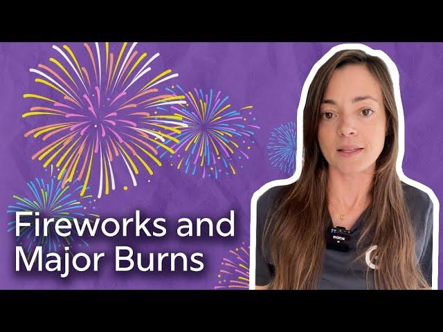 4th of July: Fireworks and Major Burns