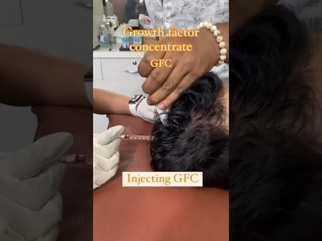 GFC, or Growth Factor Concentrate, is a treatment designed to promote hair growth and combat hair