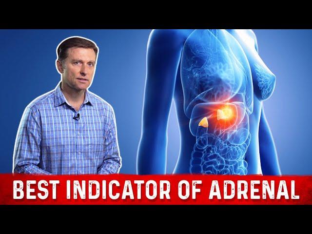 Dr.Berg Unfolds the Biggest Symptom of Adrenal Fatigue