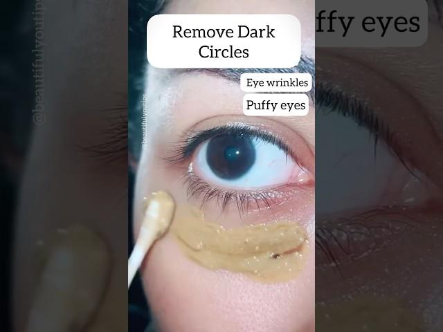 3 Nights Remove Dark Circles/Eye Wrinkles/puffy eyes| Young Eyes #darkcircles #skincare #shorts