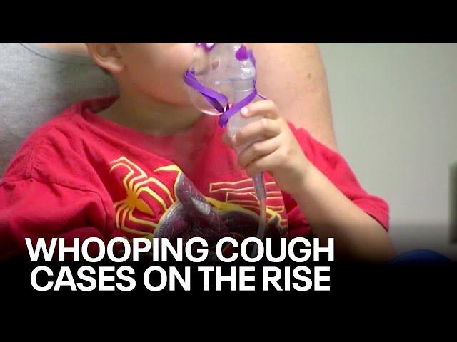 Whooping cough in Wisconsin; cases much higher than previous years | FOX6 News Milwaukee