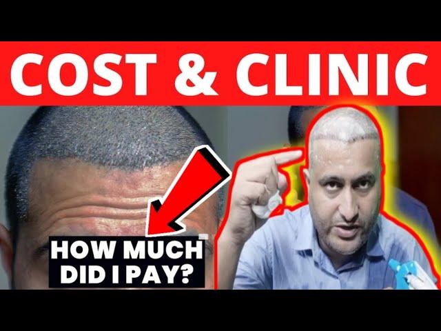 Hair Transplant Price | Hair Transplant cost | Hair Transplant in Pakistan | Hair Transplant Results