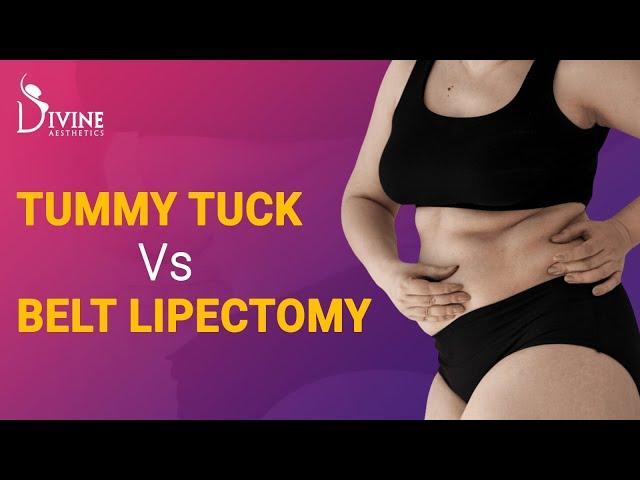 Tummy Tuck vs Belt Lipectomy Plastic Surgery | Dr. Amit Gupta Best Plastic Surgeon in India