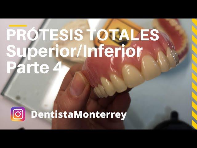 PASOS Prácticos #PrótesisTotalesParte4 Prueba dientes/Ajustes/PrótesisTerminada #DentaduraCompleta