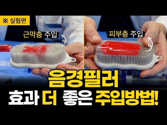음경필러 효과, 넣는 위치에 따라 효과가 달라집니다. How to get the penile filler effect better. | #남성필러 #음경필러 #남성확대