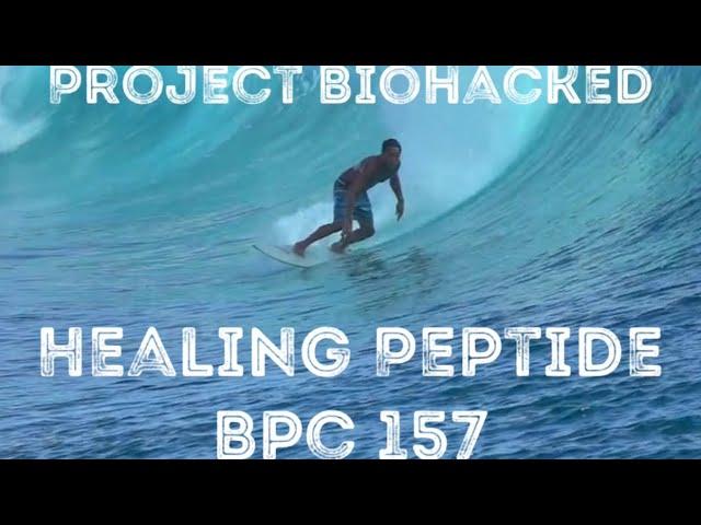 My experience with Bpc 157 for “Leaky Gut” and injury repair