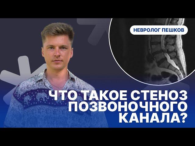 ЧТО ТАКОЕ СТЕНОЗ ПОЗВОНОЧНОГО КАНАЛА ? Невролог Пешков