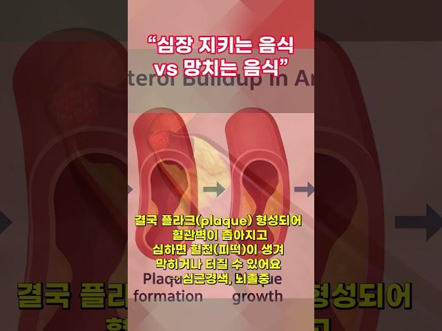 혈관 막히는 음식, 매일 드시고 계신가요 #건강정보 #시니어정보#좋은콜레스테롤#나쁜콜레스테롤#HDL음식#LDL피해야할음식