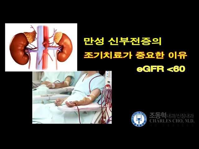 신부전의 조기치료 - [조동혁 내과/신장내과] 100세 건강시대