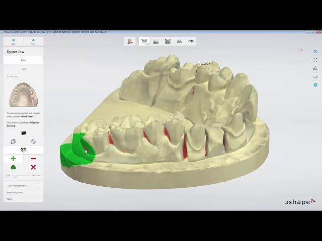 3DBioCAD - 3Shape Dental System Adaptive Scanning