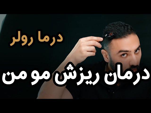 همه چیز درباره درما رولر , موثرترین روش درمان ریزش مویی که من انجام دارم میدم  (۳۷۲)