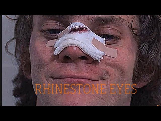 Alex DeLarge - A Clockwork Orange | Rhinestone eyes