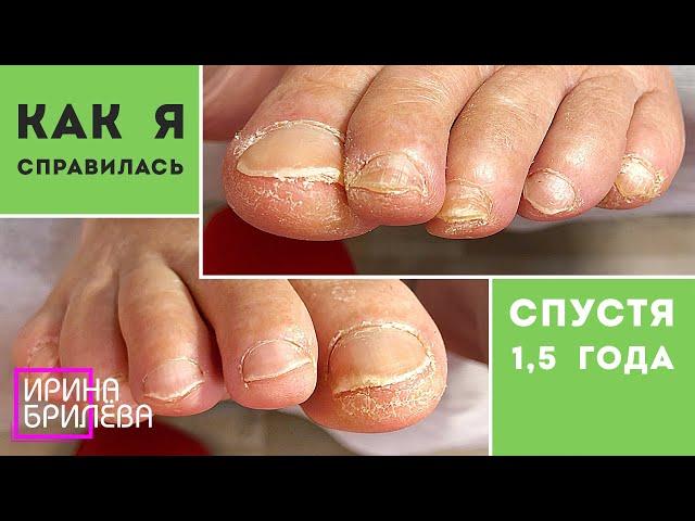 Break for 1.5 years !!!  Pedicure  Aged legs  Irina Brilyova