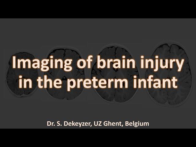 Imaging the preterm brain! Periventricular leukomalacia and beyond.