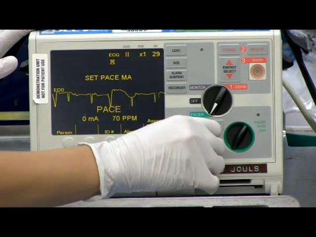 Transcutaneous cardiac pacing in a patient with third-degree heart block