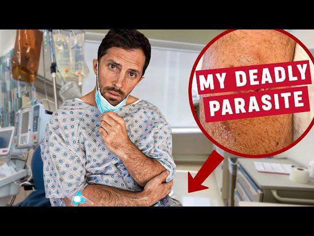 My Travel Nightmare: Surviving a Rare Amazon Disease (Leishmaniasis)