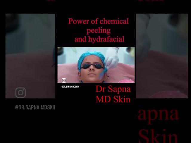 #chemicalpeel #hydrafacial #skinglow #skinwhitening #skinbrightening #drsapna #dermatologist #skin