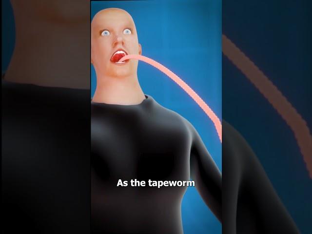 What Is A Tapeworm? 