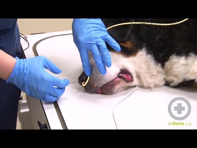 How to Place a Nasogastric (NG) Feeding Tube