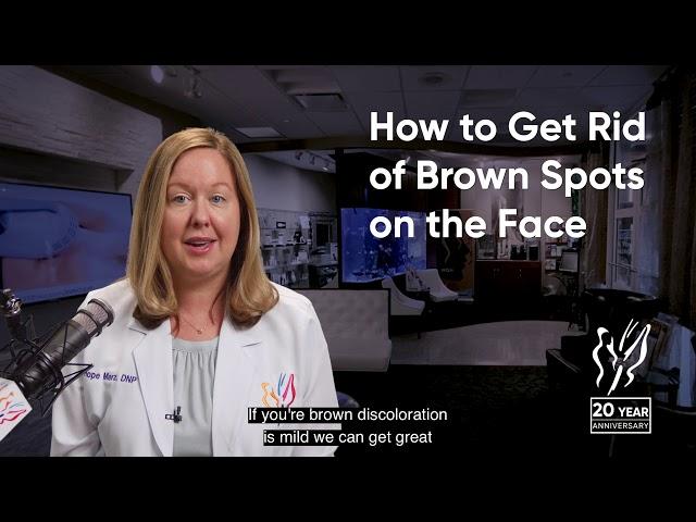 How To Get Rid Of Brown Spots on Face (Best Brown Spot Removal)