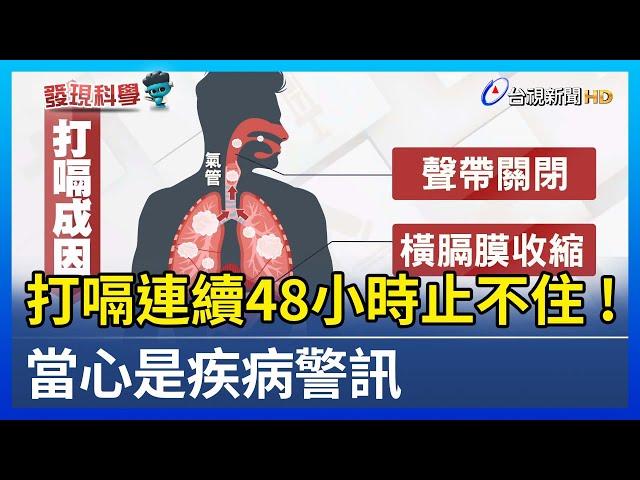 打嗝連續48小時止不住! 當心是疾病警訊【發現科學】