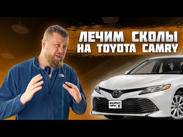 КАК ЗАКАПАТЬ СКОЛЫ НА АВТОМОБИЛЕ?