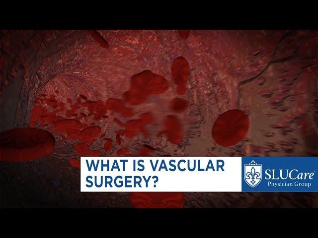 What is Vascular Surgery?