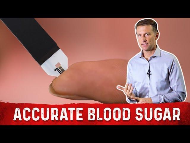 The Most Accurate Method To Test Blood Sugar is NOT A1C Test – Dr. Berg