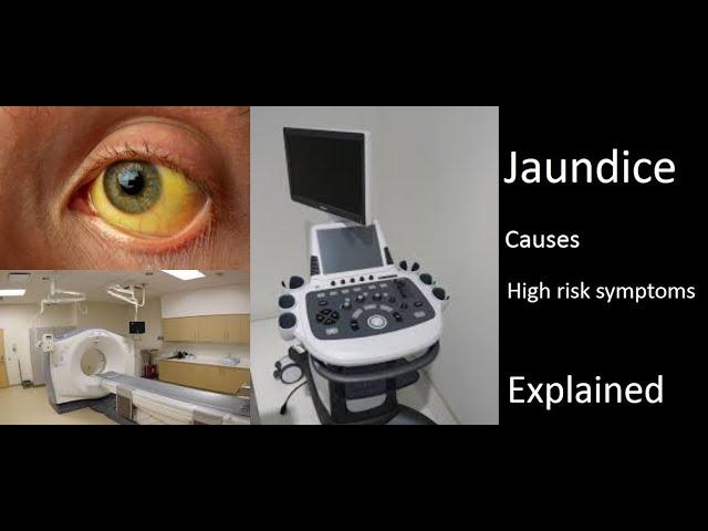 Jaundice - Causes and Symptoms I Patient education video in Hindi I Dr Ashish Sachan