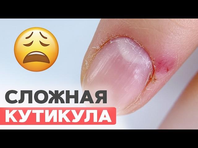 ШОК! Рваные заусенцы? Безопасный маникюр за 5 шагов – Результат ДО/ПОСЛЕ