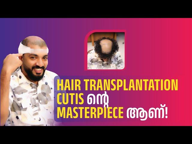 HAIR TRANSPLANTATION CUTIS ന്റെ MASTERPIECE ആണ്!