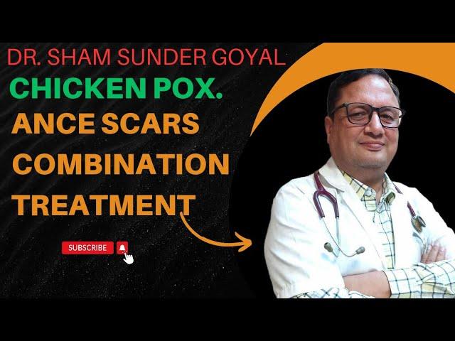 Chicken Pox | Acne Scars Treatment | Combination Treatment | Kayakalp Laser Clinic