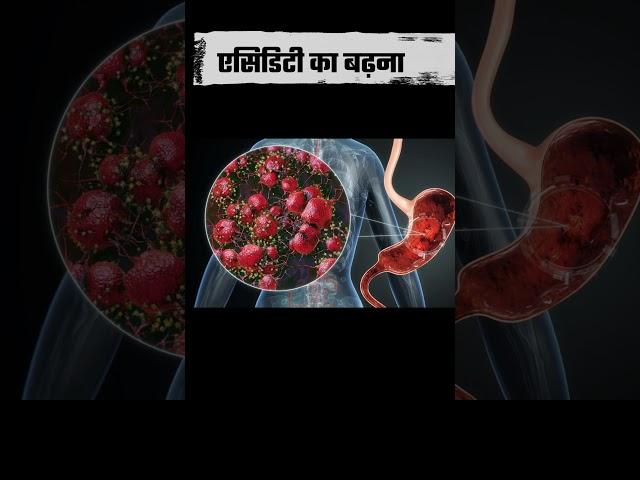 एसिडिटी का बढ़ना  Acid Levels Spike! Animated Video Explains Why