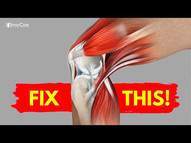 How to Fix Knee Pain for Good (AT HOME!)