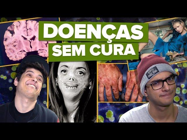 AS RARAS DOENÇAS SEM CURA   (Você Sabia?)