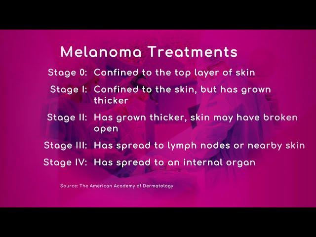 Stages of Melanoma