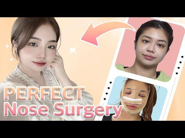 I Transformed with Rhinoplasty!