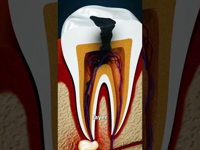 Why Grinding Your Teeth Is Bad 