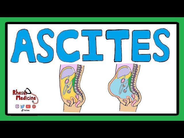 ASCITES - Serum Ascites Albumin Gradient (SAAG) | Ascites Pathophysiology | Ascites Causes