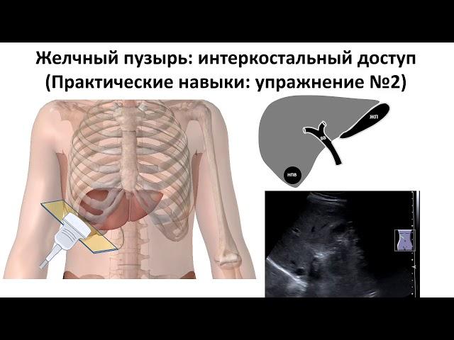 УЗ анатомия ЖП и желчных путей