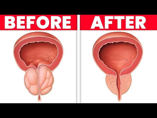 Drink 1 CUP PER DAY to Shrink an Enlarged Prostate