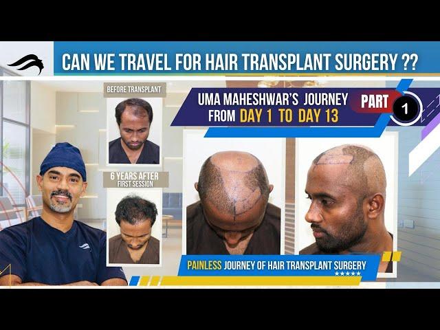 Hair Transplant In Chennai | Best Center Cost Surgeon & Results Of Hair Transplant Of Chennai