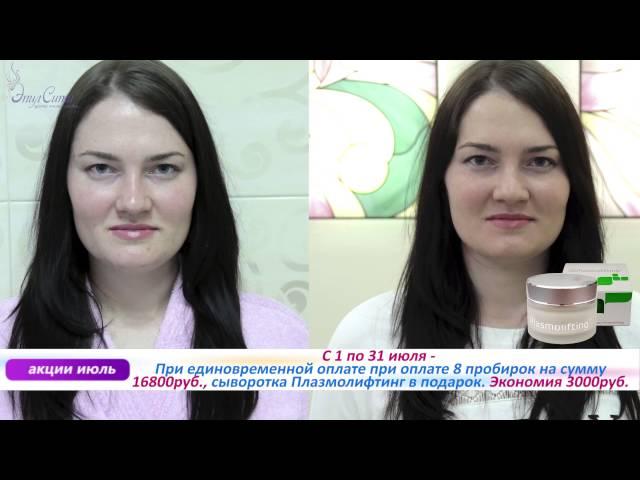 Акции июля в Эпил Сити. Центры косметологии в Москве!