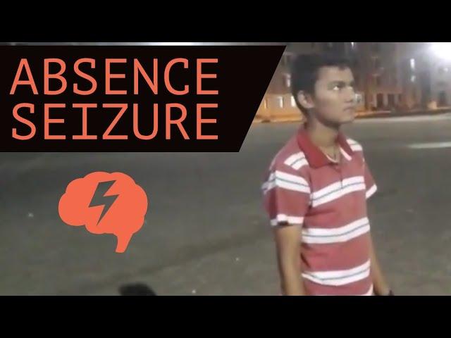 Absence seizure | Types of seizures | Epilepsy