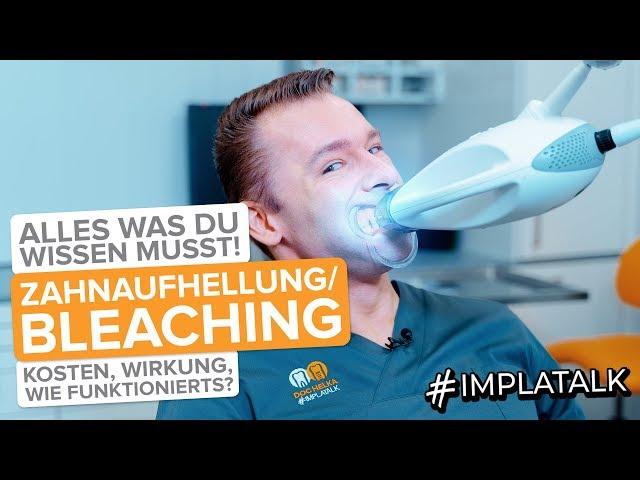 Bleaching / Zahnaufhellung - Alle Fakten : Ablauf, Kosten, Haltbarkeit, Risiken + Vorher-Nachher