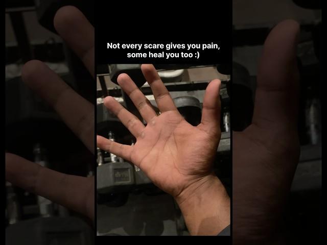 Some scares do heal… #explorefitness #youtubeshorts #trending #gym #fitnessmotivation #fyp #explore