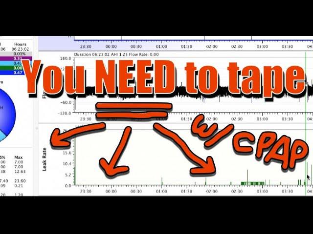 3 Reasons to MUST Tape Your Mouth with CPAP.  OSCAR  Data Tutorial