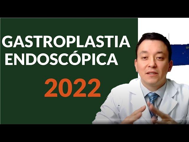 Gastroplastia Endoscópica | Como Funciona - *Atualizado 2022*